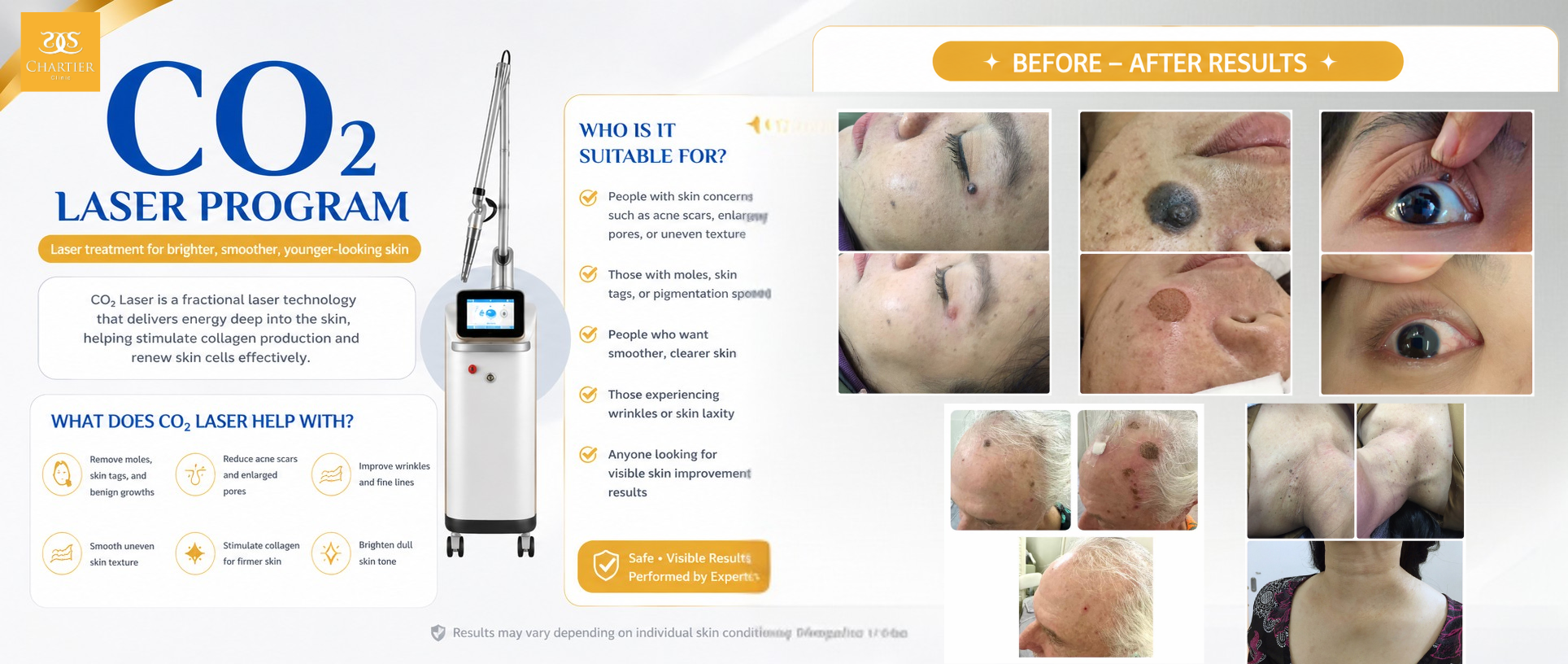 co2 laser service details