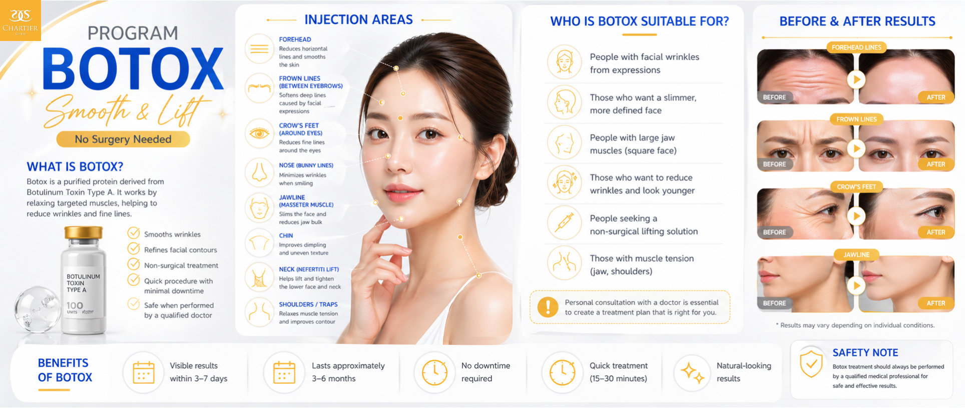 botox service details