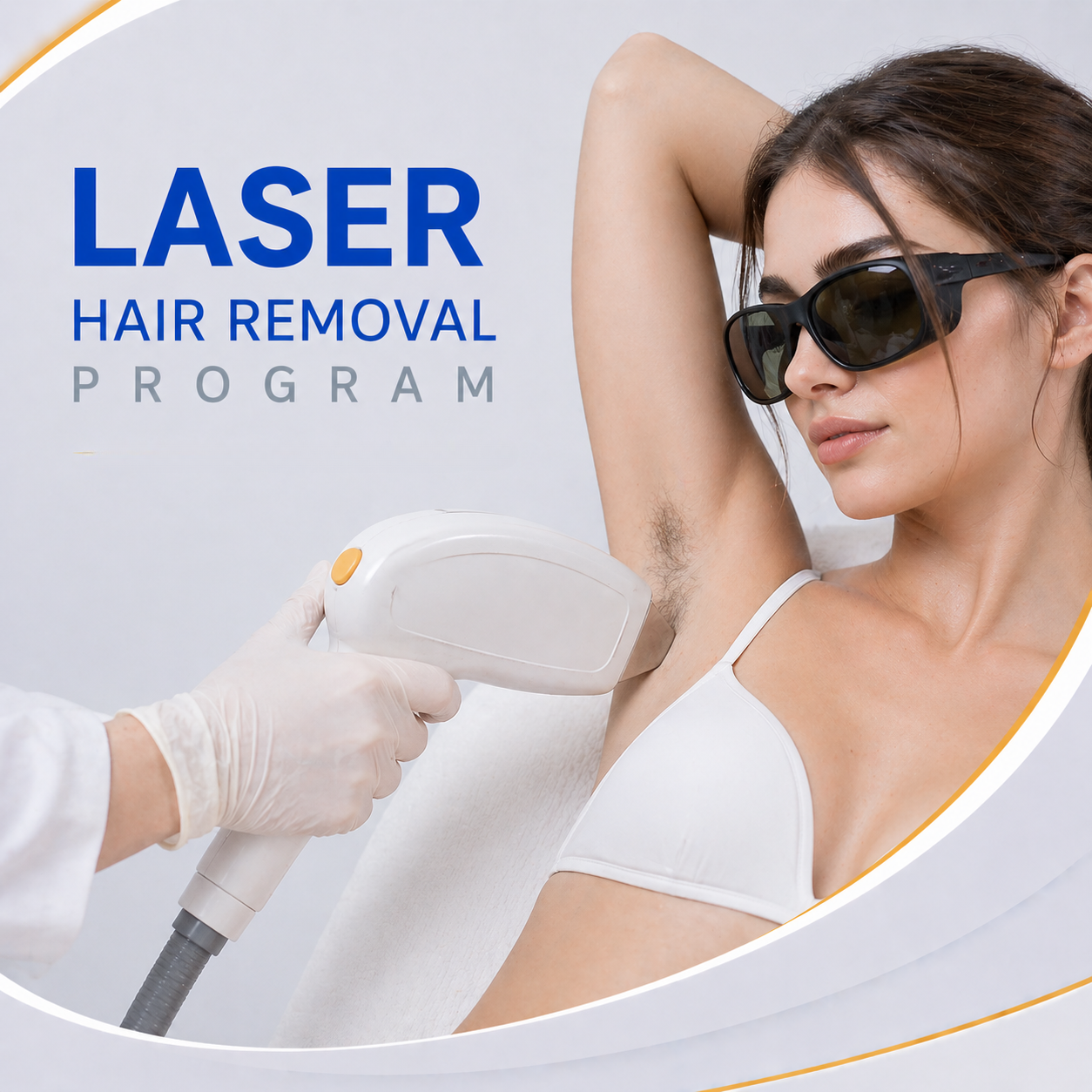hair removal laser
